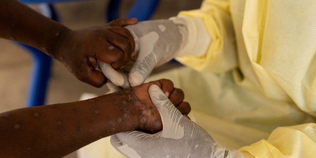 africa-declara-emergencia-em-saude-publica-por-epidemia-de-mpox