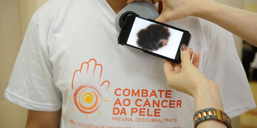 mutirao-atende-populacao-hoje,-no-dia-de-combate-ao-cancer-de-pele