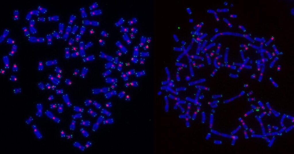 por-que-algumas-celulas-cancerosas-resistem-a-radioterapia?-estudo-explica