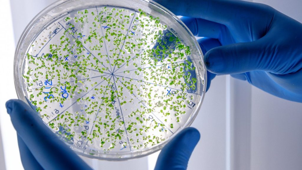 superbacteria-mortal-se-espalha-apos-resistir-a-medicamentos