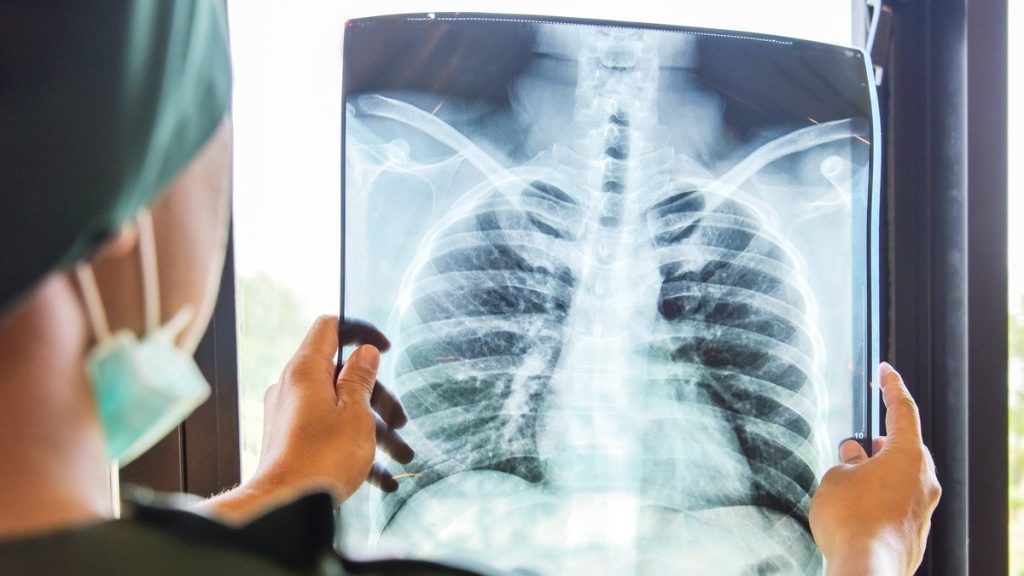 pneumonia:-o-perigo-para-as-criancas-no-brasil