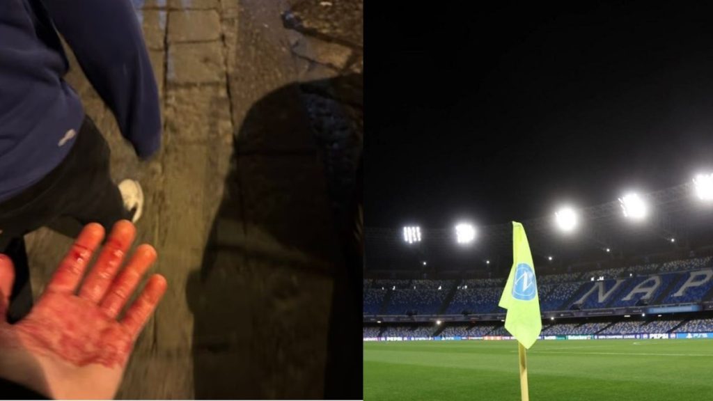 torcedores-do-chelsea-sofrem-emboscada-antes-de-jogo-da-champions