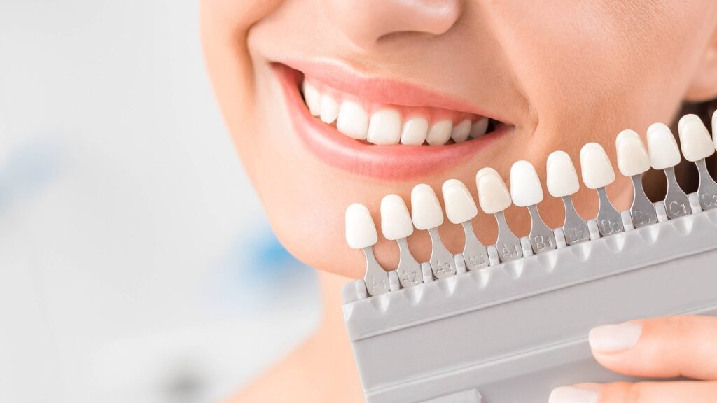 rejeicao-de-implante-dentario:-devo-me-preocupar?