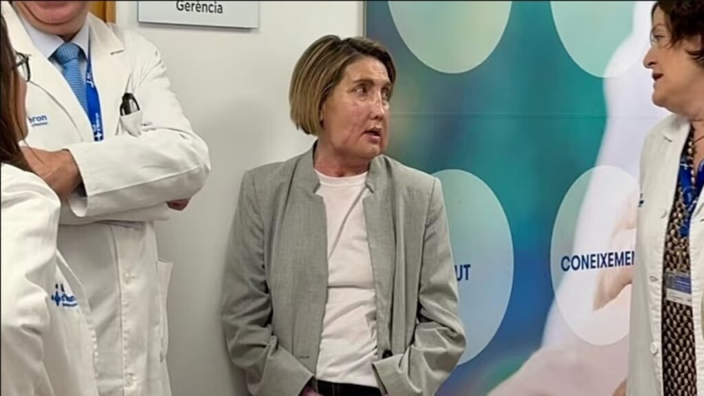 espanha-realiza-1o-enxerto-facial-com-doador-em-morte-assistida