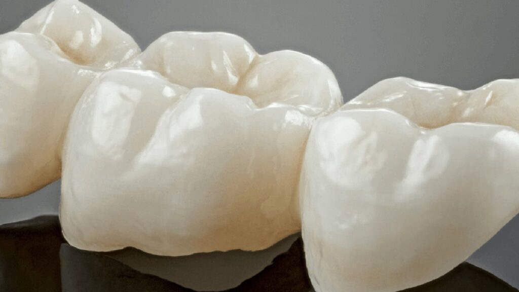 zirconia-na-odontologia:-tecnologia,-resistencia-e-estetica