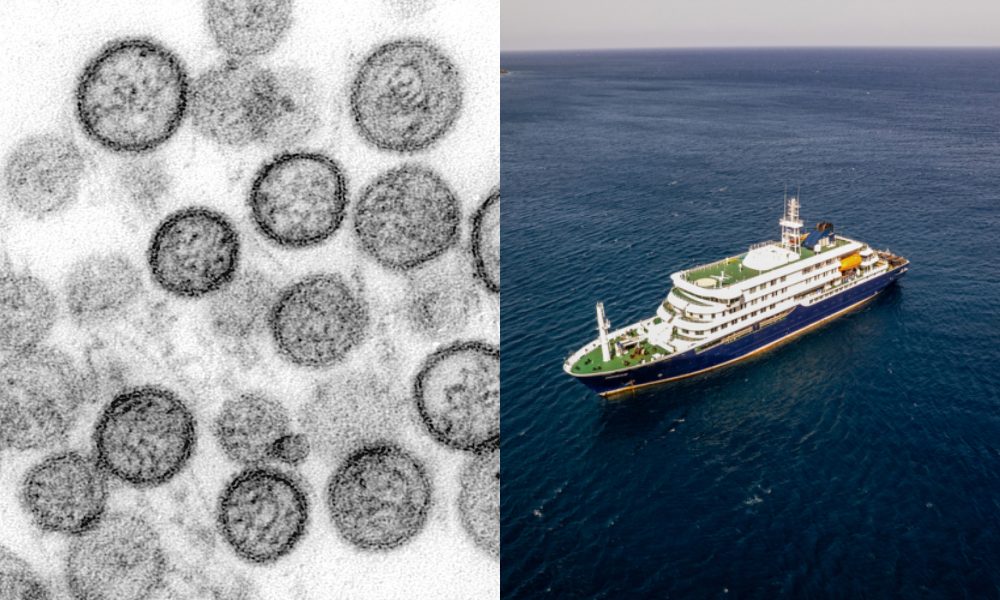 dois-passageiros-repatriados-de-cruzeiro-testam-positivo-para-hantavirus