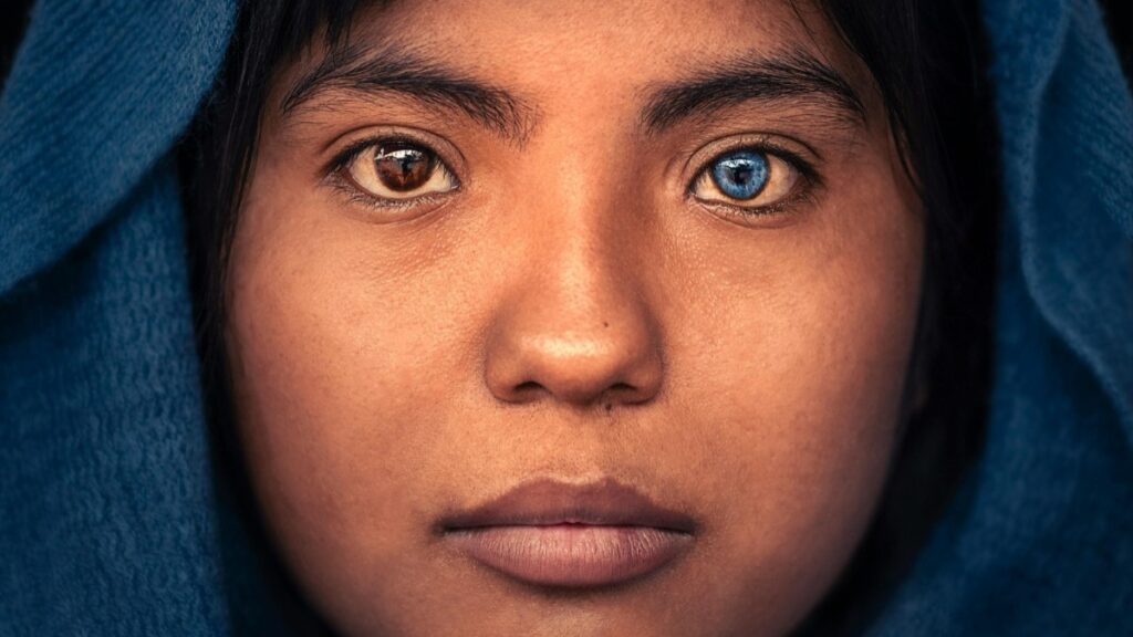 olhos-de-cores-diferentes-podem-indicar-problemas-de-saude?